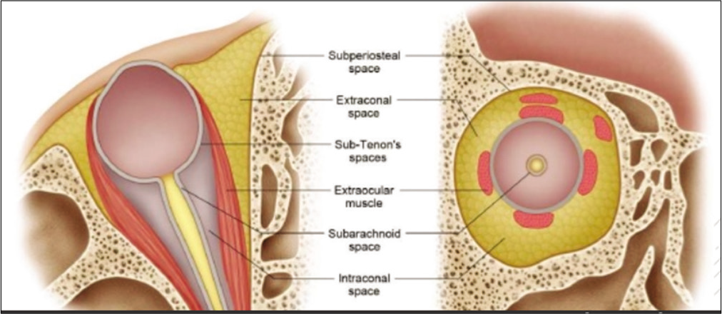 anatomy orbital cellulitis